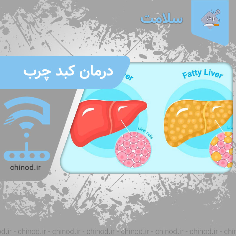 درمان کبد چرب Fatty liver چینود chinod