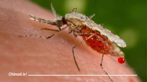 گزیدگی پشه Mosquito bite چینود chinod