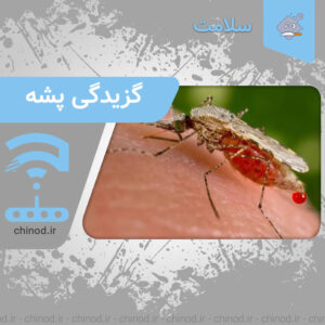 گزیدگی پشه Mosquito bite چینود chinod